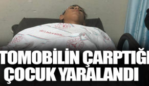 OTOMOBİLİN ÇARPTIĞI ÇOCUK YARALANDI