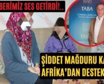 Haberimiz Ses Getirdi!.. Şiddet Mağduru Kadına Afrika’dan Destek Geldi