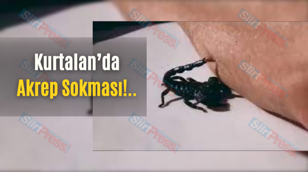 Kurtalan’da Akrep Sokması!..