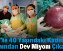 Siirt’te 40 Yaşındaki Kadının Karnından Dev Miyom Çıkarıldı