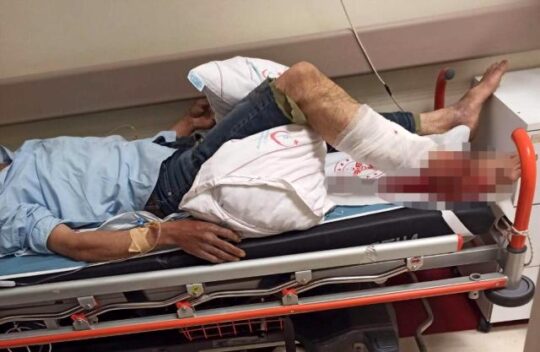 Siirt’in Eruh ilçesinde koyunlarını otlatan çoban ayının saldırısına uğradı. Yaralanan