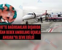 Siirt’te Bağırsakları Dışarıda Doğan Bebek Ambulans Uçakla Ankara’ya Sevk Edildi