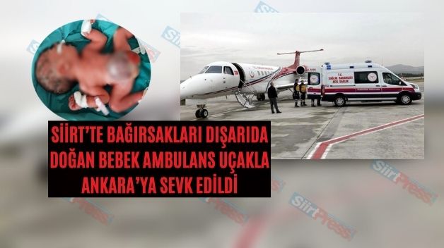 Siirt’te Bağırsakları Dışarıda Doğan Bebek Ambulans Uçakla Ankara’ya Sevk Edildi