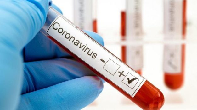 Siirt’te Coronavirüs (COVİD-19) Pandemisini yok etmeye yönelik önlemler alınmaya devam