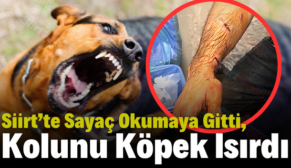 Siirt’te Sayaç Okumaya Gitti, Kolunu Köpek Isırdı