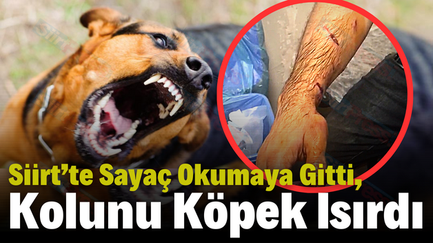 Siirt’te Sayaç Okumaya Gitti, Kolunu Köpek Isırdı