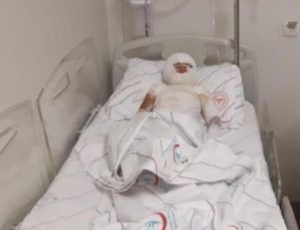 Siirt’te üzerine kaynar çorba dökülen 4 yaşındaki Sakine Ö., isimli