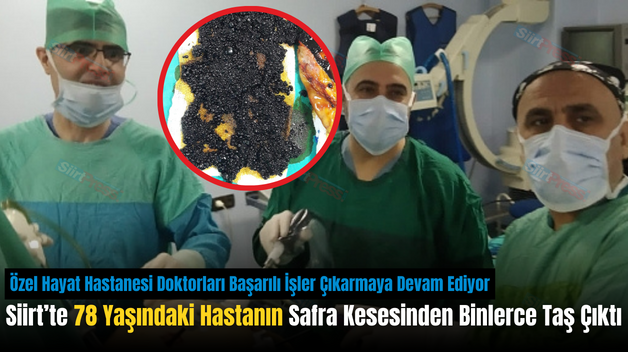 Siirt’te 78 Yaşındaki Hastanın Safra Kesesinden Binlerce Taş Çıktı