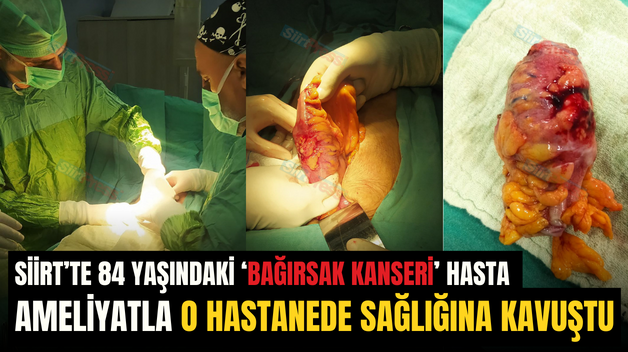 Siirt’te 84 Yaşındaki ‘Bağırsak Kanseri’ Hasta Ameliyatla O Hastanede Sağlığına Kavuştu