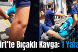 Siirt’te Bıçaklı Kavga: 1 Yaralı