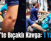 Siirt’te Bıçaklı Kavga: 1 Yaralı