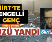 SİİRT’TE ENGELLİ GENÇ EVLERİNDE ÇIKAN YANGINDA YÜZÜ YANDI