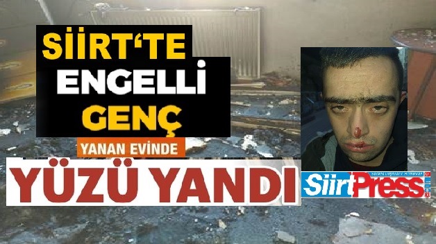 SİİRT’TE ENGELLİ GENÇ EVLERİNDE ÇIKAN YANGINDA YÜZÜ YANDI