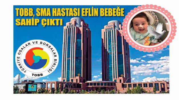 TOBB, SMA HASTASI SİİRTLİ EFLİN LİNA BEBEĞE SAHİP ÇIKTI